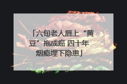 六旬老人唇上“黄豆”拖成癌 四十年烟瘾埋下隐患
